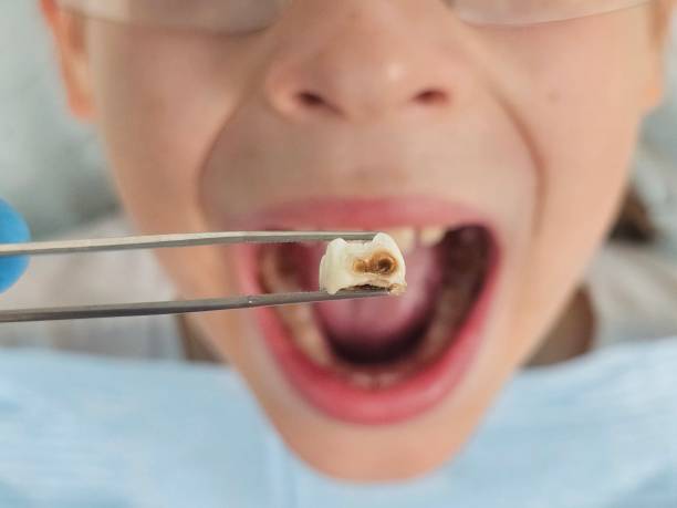 Best Emergency Dentist for Knocked-Out Tooth in Thornport, OH