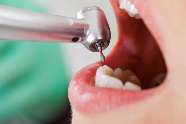 Best Urgent Dental Care for Toothache in Thornport, OH